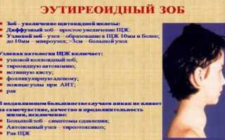 Что такое эутиреоидный зоб?