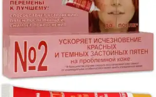 Какой крем от пятен от прыщей наиболее эффективен?