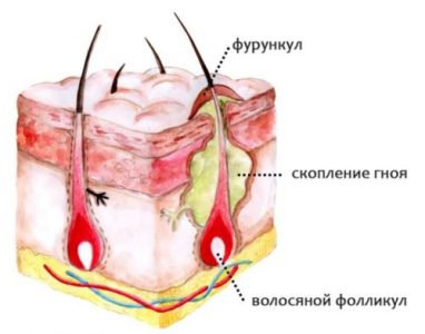 Методы лечения фото