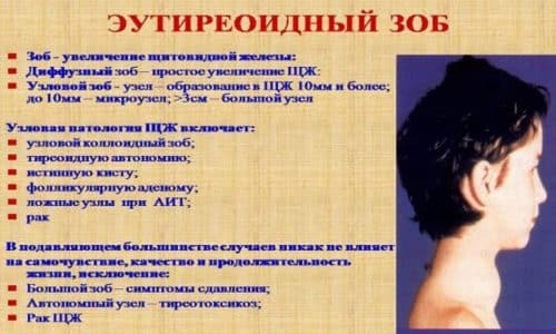 Эутиреоидный зоб - это совокупность распространенных заболеваний щитовидной железы