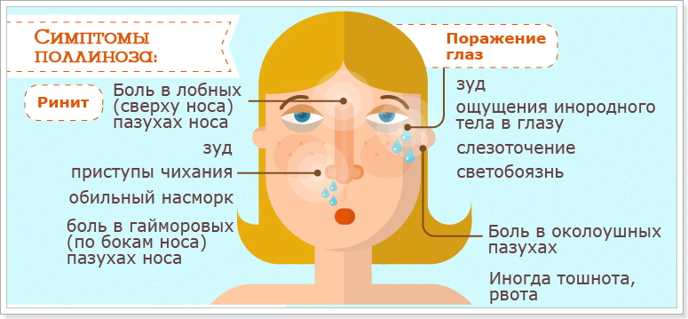 Основные симптомы поллиноза