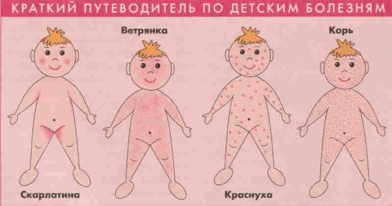 Виды инфекционной сыпи