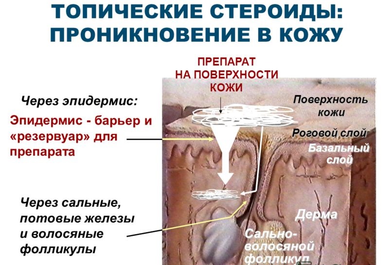 Схема воздействия топического стероида